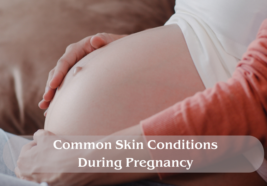 Common Skin Conditions During Pregnancy